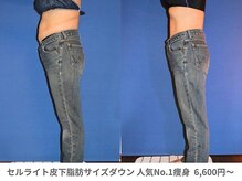 アンシャンテ 神戸元町店(Enchante)/痩身ダイエット　神戸元町三ノ宮