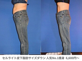 アンシャンテ 神戸元町店(Enchante)/痩身ダイエット　神戸元町三ノ宮