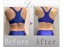 ステラ(STELLA)/上半身プレミアムの効果