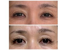 オリーブ(Olive)の雰囲気（パッチリと若々しい印象に♪目元専門エステ）