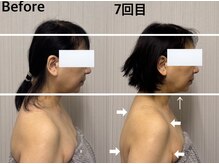 ベール(BEHL)/コルギのBefore After