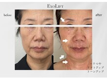 ニーマルイチ(201)の雰囲気（細胞レベルで改善！専門機関も驚きの最新美容ケア◎）