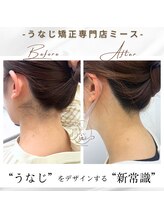ミース 長野店/うなじ矯正◆ビフォーアフター