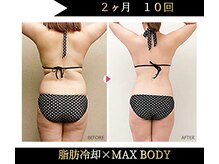 青空(SORA KOKURA SALON)の雰囲気（普段見えづらいお背中・ヒップのお肉も脂肪冷却で徹底ケア！）