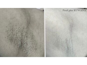 パールプラス 桑名店(Pearl plus)/before / after