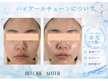 ユアーズ ビューティー(YOURS beauty)/ハイアールチューン