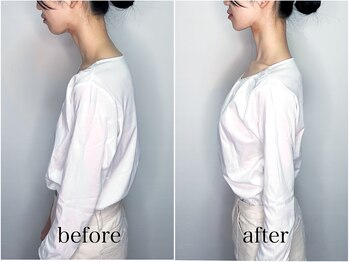 サンク(Cinq)/整体と猫背矯正にてスマホ首改善