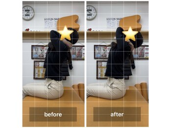 ナオル整体 飯田橋院(NAORU整体)/Before After/飯田橋/整体・矯正