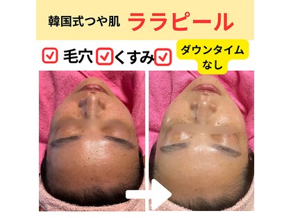 シェービング お顔そりサロン せんすの写真