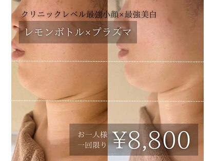 エステサロン ジュエル 高松レインボー店(JEWEL)の写真