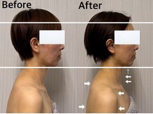 ベール(BEHL)/コルギのBefore After