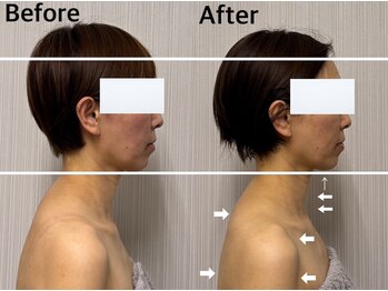 ベール(BEHL)/コルギのBefore After