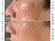 ゼアー(THERE FY.)の写真/【理想を叶える最適なメニューをご提案☆】初めての方も本気でお肌を変えるなら当店へお任せください＊