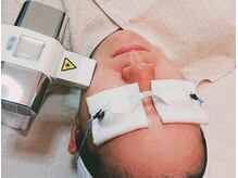 シックワークス オット(Chic Work's Otto)/ライトフェイシャル