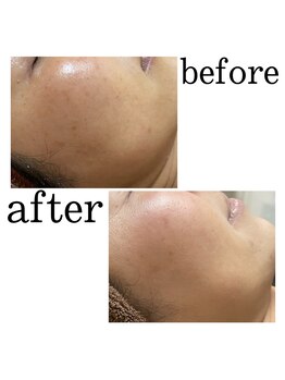 フェザー(feather)/肌育の効果