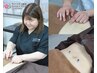 【お身体の状態に合わせた鍼施術！】★全身鍼施術★