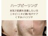 【モニター様限定】幹細胞ハーブピーリング