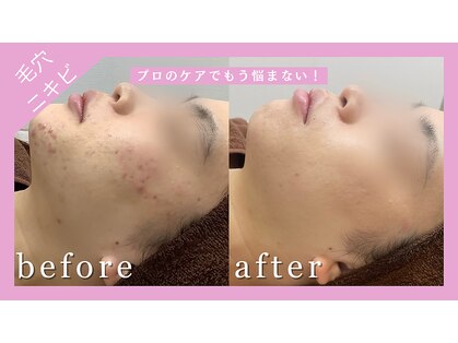 レイ(0 Lei)の写真