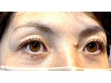 フーチークーチー リアン(FUCHI-KUCHI Lien)/ラッシュリフト（まつげパーマ）