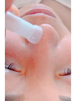 ラブリノア(Love Linoa)/毛穴の黒ずみ改善