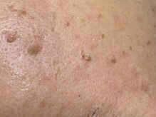 サラグランデ(Sara Grande)/ごろっと出てきます！