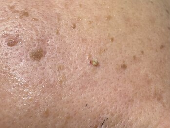 サラグランデ(Sara Grande)/ごろっと出てきます!