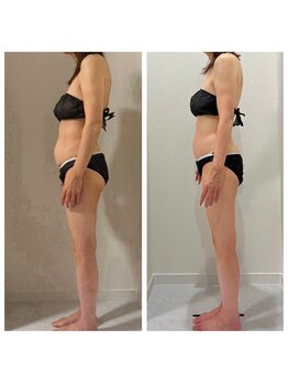 ヴィナーレ(VINARE)/痩身 50代のお客様