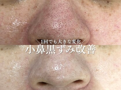 ルアナアイナ 大分の写真