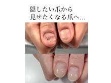 エスネイル 天王寺店(S-nail)の雰囲気(凹凸のあるお爪もお任せください)