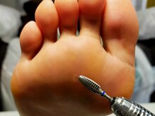 ナビネイル(Nabi nail)/角質除去（角質ケア）