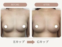 ウェルバスト(Well Bust)/【バストアップ例】E→Gカップ