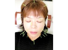 なかしま鍼灸整骨院
