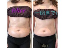 フェリーチェ 富山店/たった１回で☆