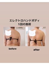 ハル(Haru)/施術前後