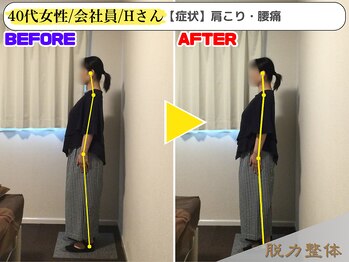 幸せのもり整体院/40代女性/会社員/Hさん