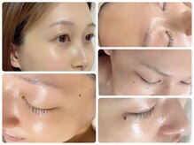 アップル マリーの雰囲気（こだわりのハンド施術…丁寧に…むきタマゴ肌…キメ整う美肌へ）
