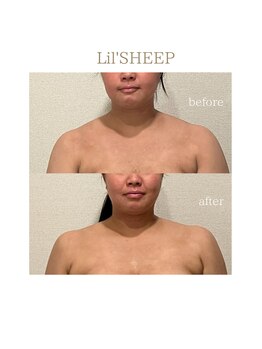 リルシープ(LIL'SHEEP)/ブライダルエステ