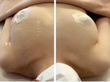 バステト(BASTET)/バスト専用美容液の効果