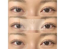 リーベスト 心斎橋店(REBEST)/