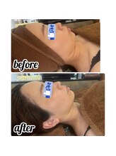 コオリナ(Ko Olina)/スペシャル小顔フェイシャル