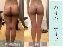 スリムプロ 堀江店(Slimpro)の雰囲気（花嫁様に特化した小顔＆痩身ブライダルメニューも大人気◎）