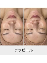 リムビューティー 自由が丘(RymBeauty)/肌表面と内面の両方にアプローチ