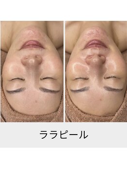 リムビューティー 自由が丘(RymBeauty)/肌表面と内面の両方にアプローチ