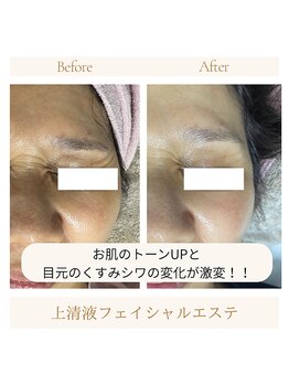 ランプシー(Lampsi)/次世代エステ