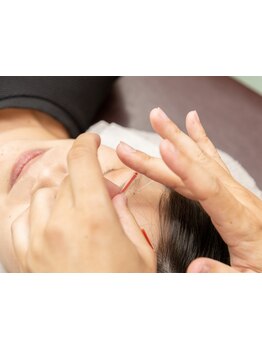 鍼灸施術を受けたい