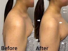 ベール(BEHL)/コルギのBefore After