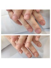 リーフ(Leaf)/ジェルで自爪育成