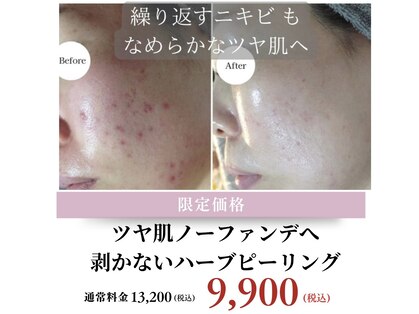 ネーム(Nemu)の写真