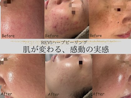 ルミライズ(lumirise)の写真