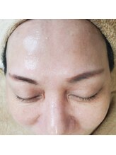 スプーンプラス アイラッシュ(spoon+eyelash)/サロンケアでお肌もツルピカ